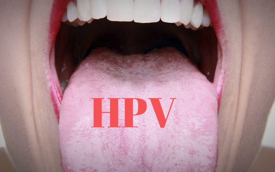 hpv nella bocca