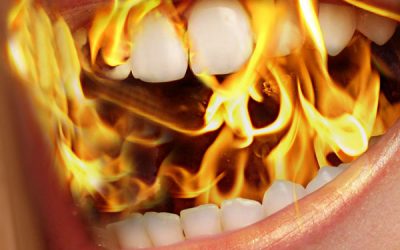 Sindrome della bocca che brucia