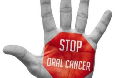 Diagnosi precoce del cancro orale