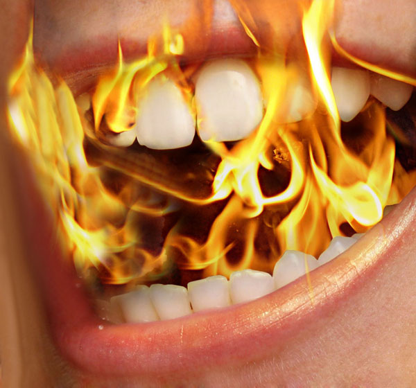 Sindrome della bocca che brucia